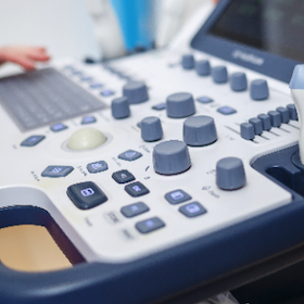 研究開発における初期研究段階から商業化段階への移行